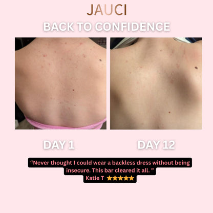 JAUCI ClearBack Bar™