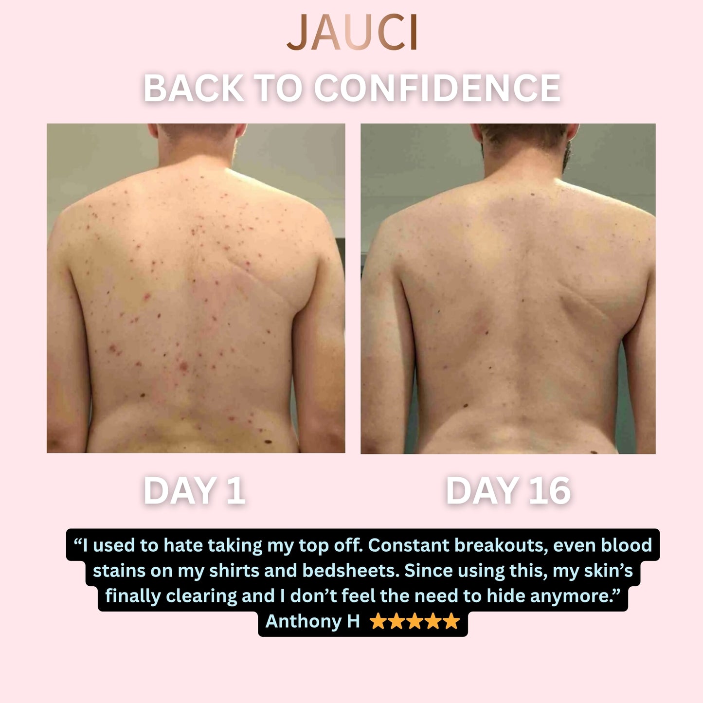 JAUCI ClearBack Bar™