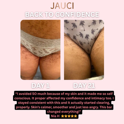 JAUCI ClearBack Bar™
