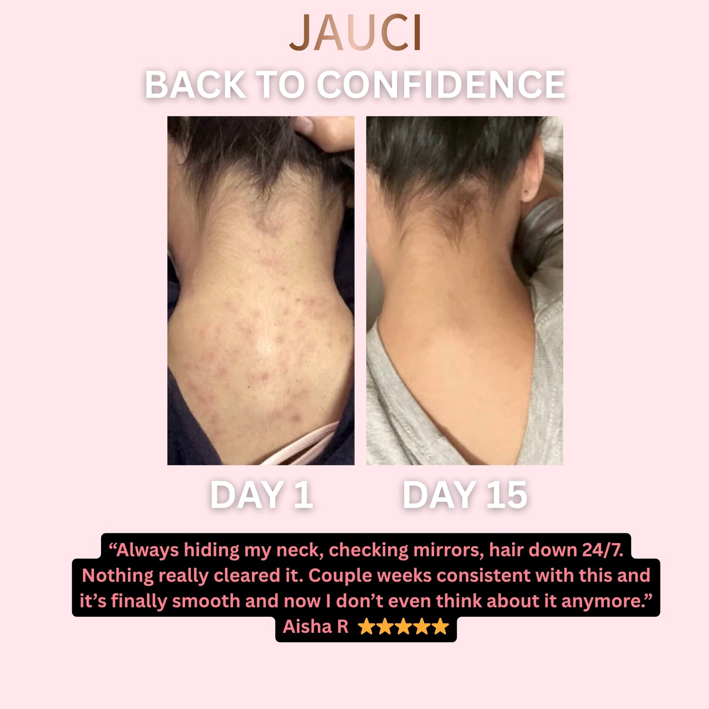 JAUCI ClearBack Bar™
