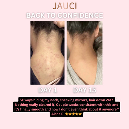 JAUCI ClearBack Bar™